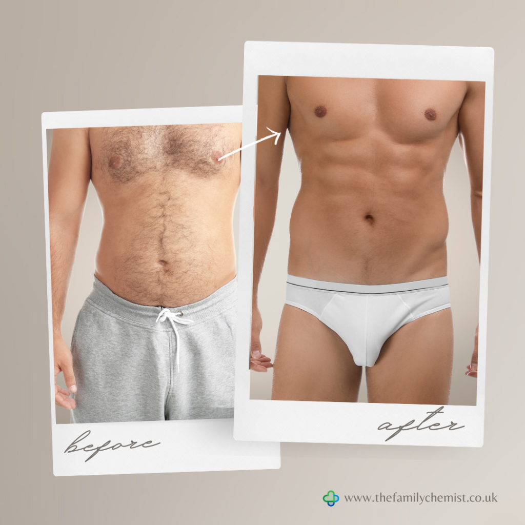 male patient lost weight before and after image