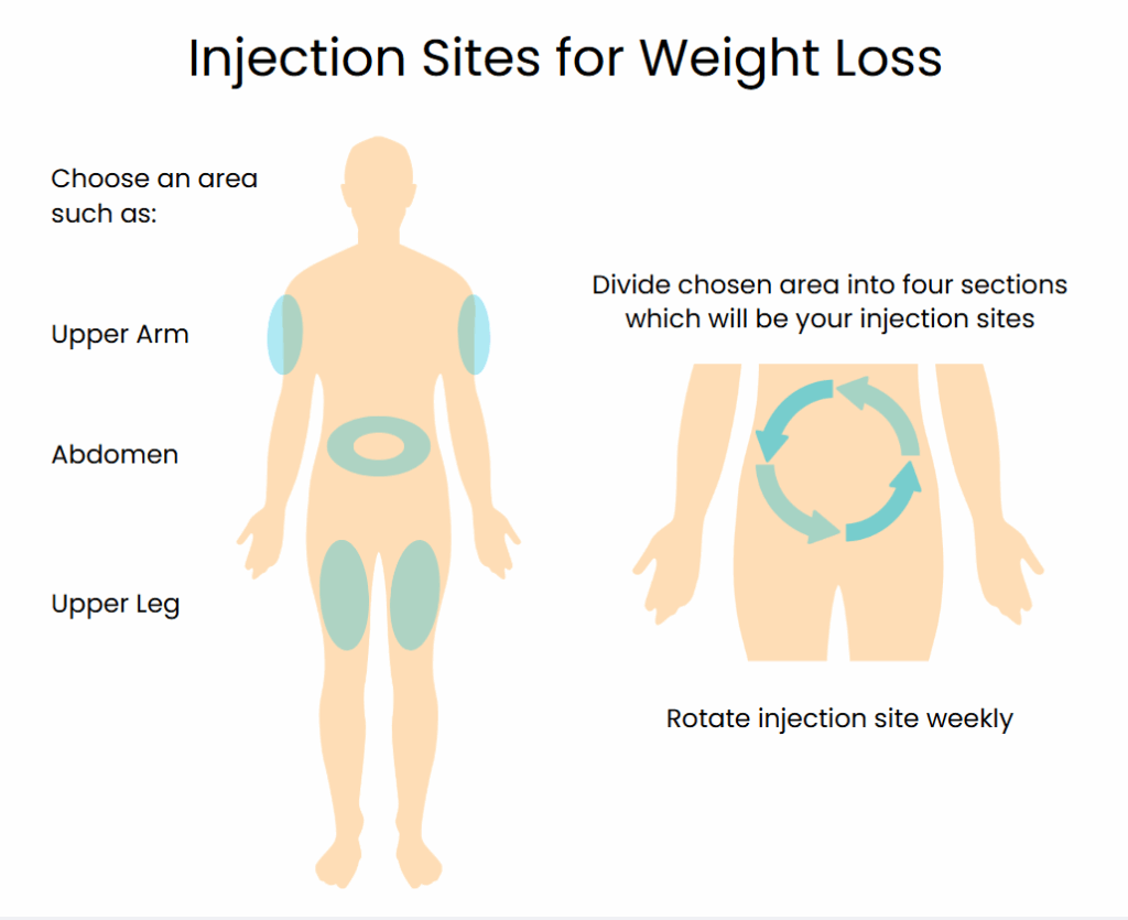 infographic injection site weight loss